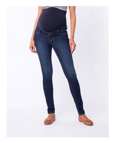 sera-MARCUS-over bump